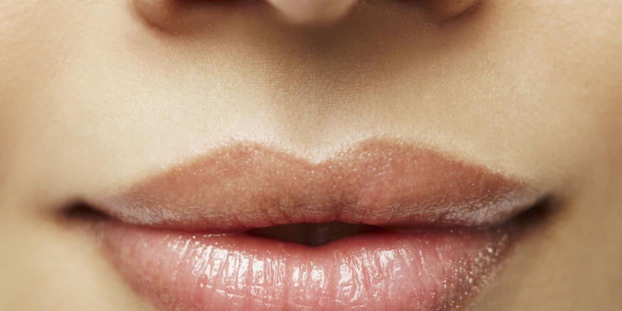 how to get rid of a lip pimple